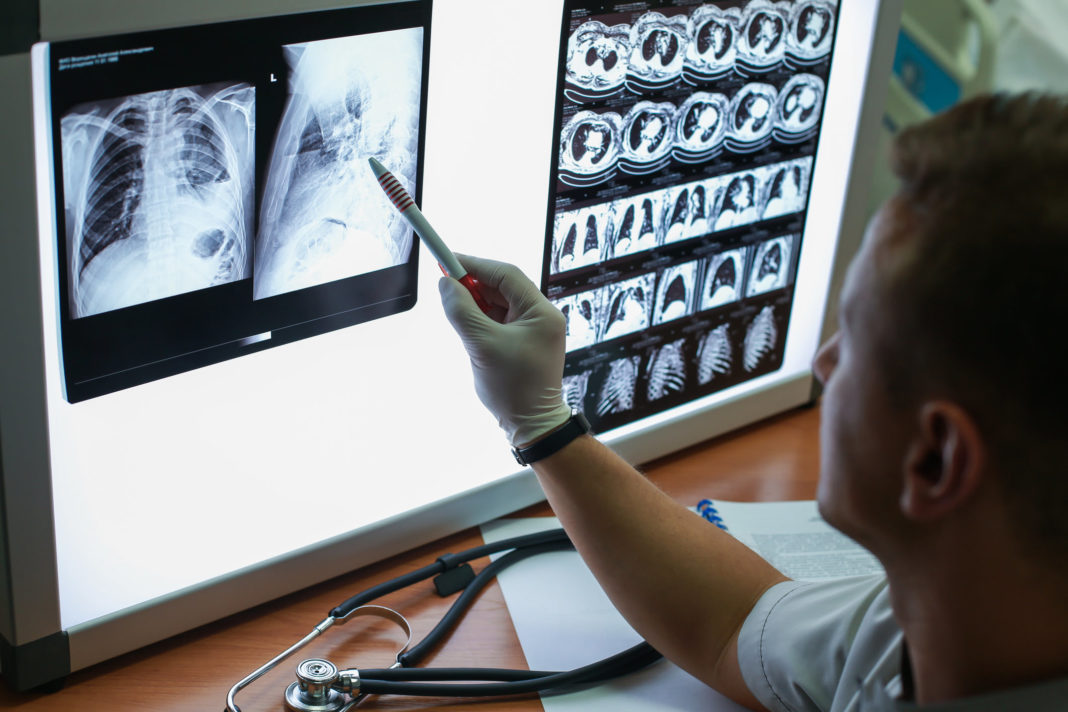 asma, EPOC, radiografía, consulta, pulmones, escáner
