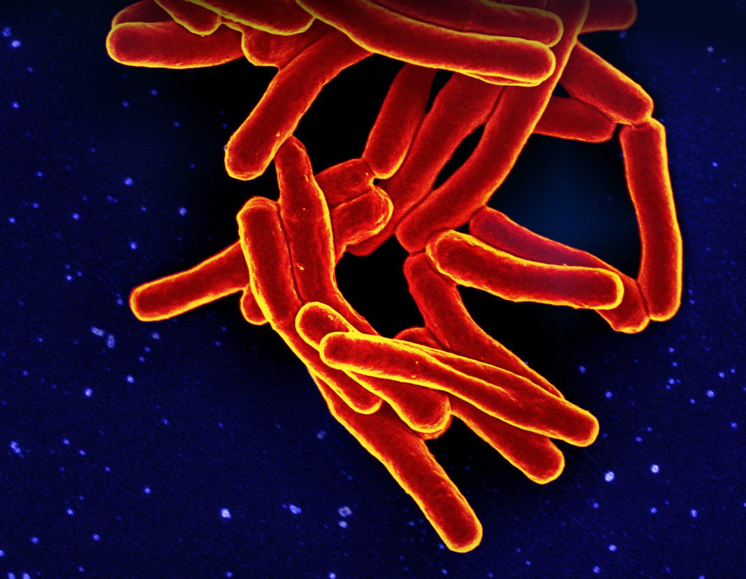 Micrografía electrónica de barrido de partículas de Mycobacterium tuberculosis (coloreadas en rojo y amarillo), la bacteria que causa la tuberculosis. NIAID