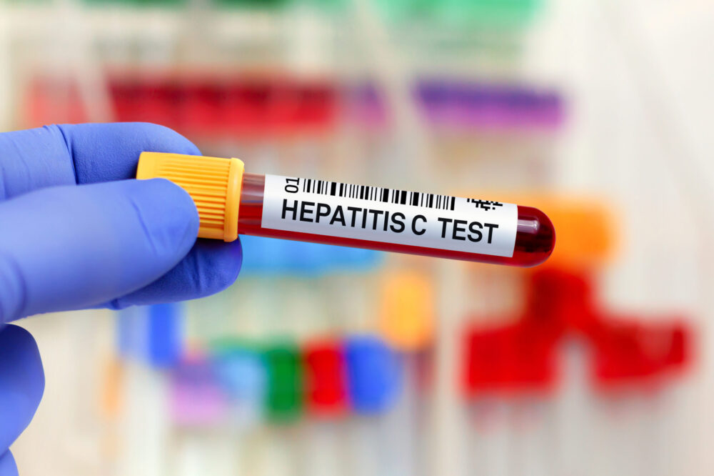 Andalusia launches plan to eradicate viral hepatitis by 2030